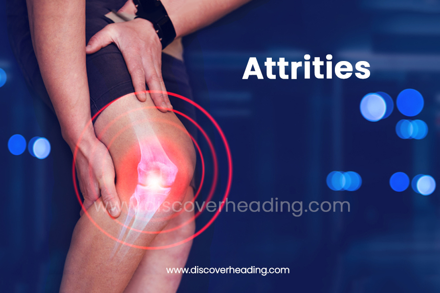 Attrities: Joint Pain, Inflammation, Causes, and Treatments